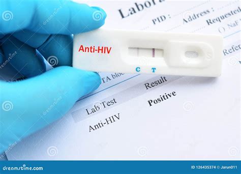 hiv positive results images